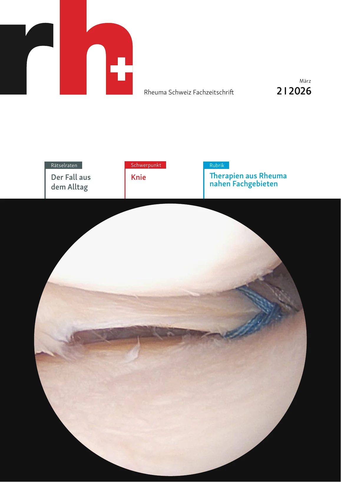 Titelblatt der Fachzeitschrift Rheuma Schweiz 2/2026 mit Schwerpunkt Knie